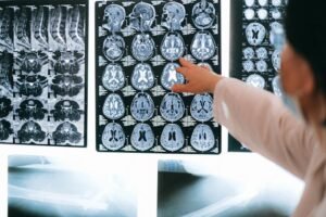 Read more about the article Mesothelioma Settlement Amounts — What Victims and Families Should Know